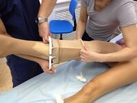 Компрессия ног после склеротерапии